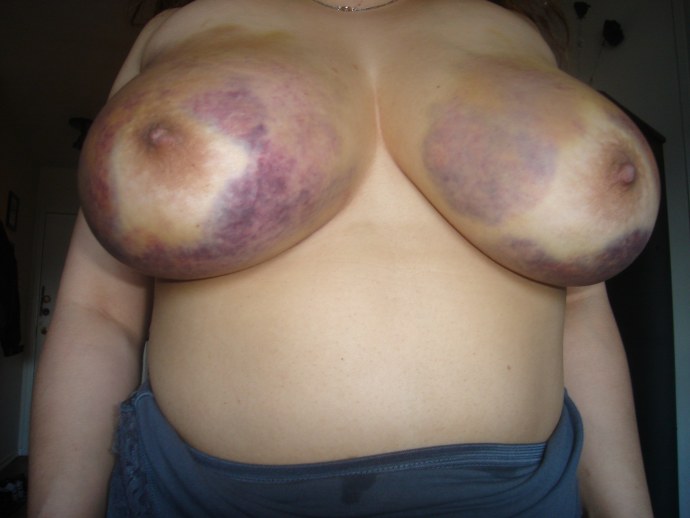 Weird ugly mature nude pussy в машине