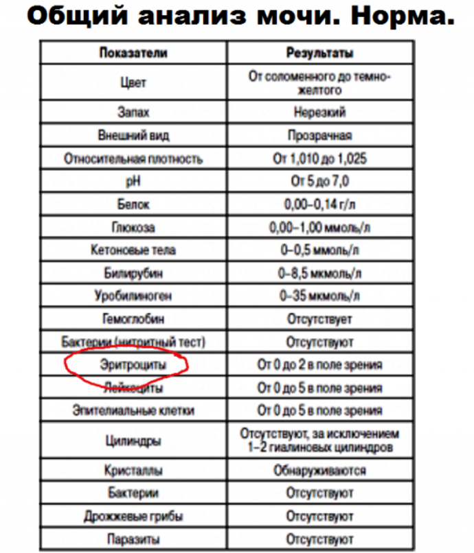 Линда Лапиньш актриса голая