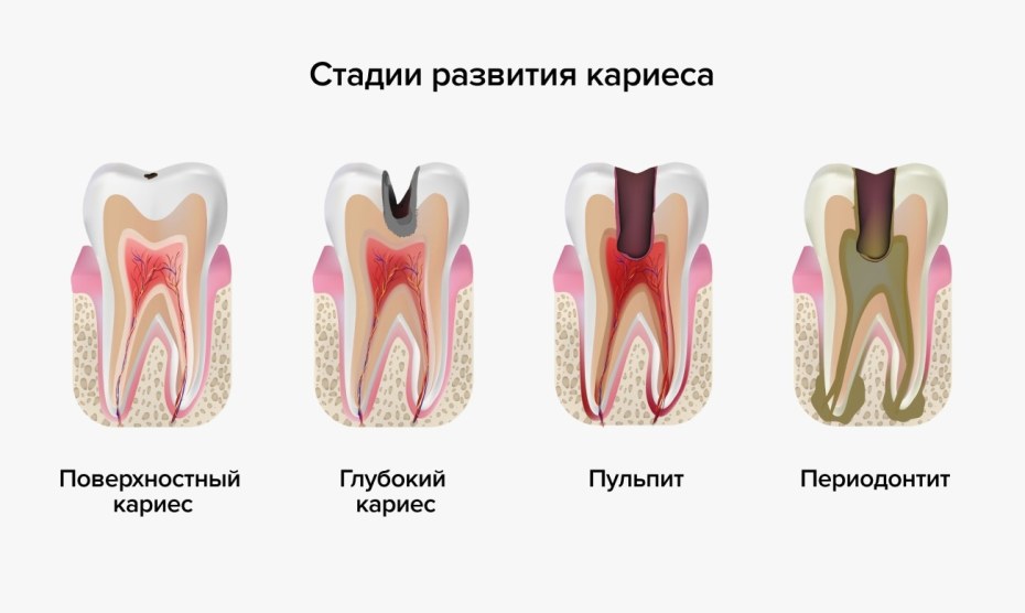 Голая с ямочкой на подбородке